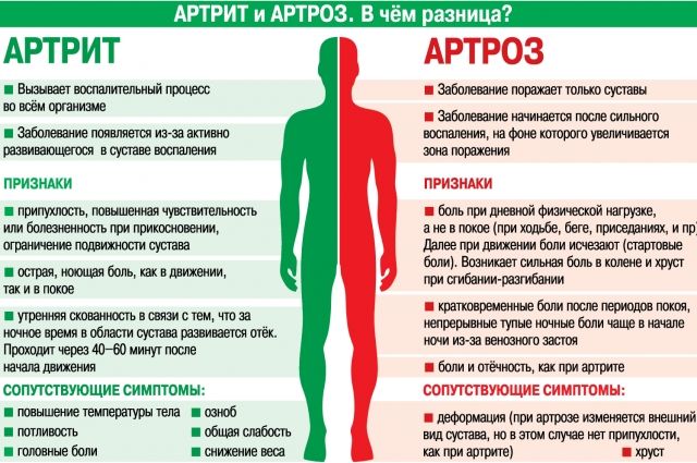 артрит и артроз отличия